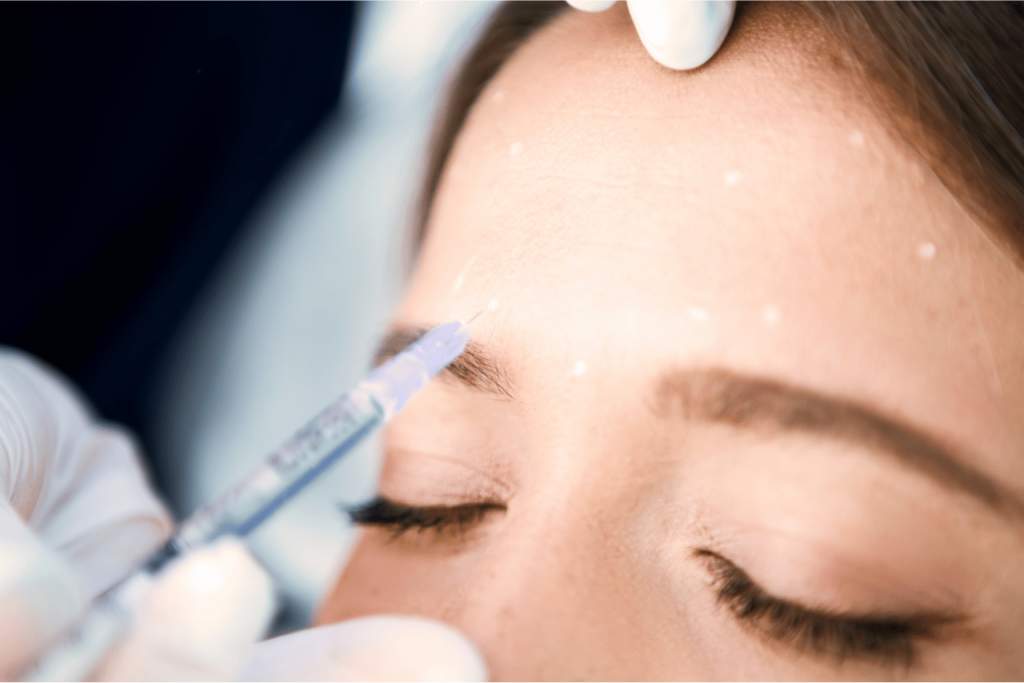Does Botox Hurt?  A woman getting Botox injections in her forehead.