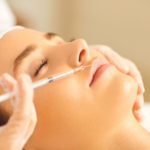 9 Botox Lip Flip Side Effects: What You Should Know