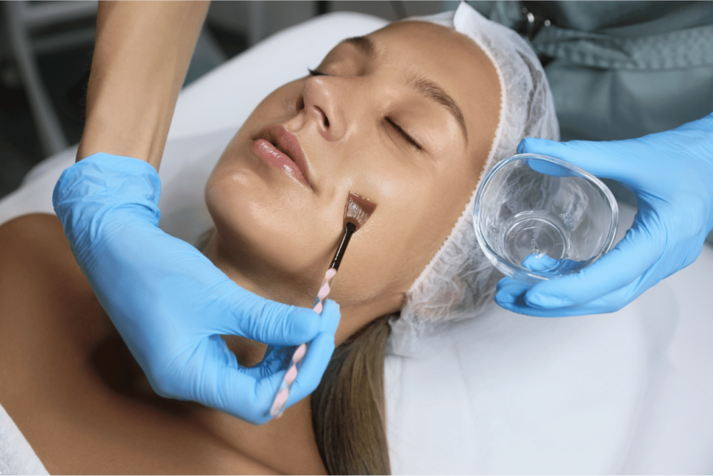 How Long Does Peeling Last After A Chemical Peel? 
