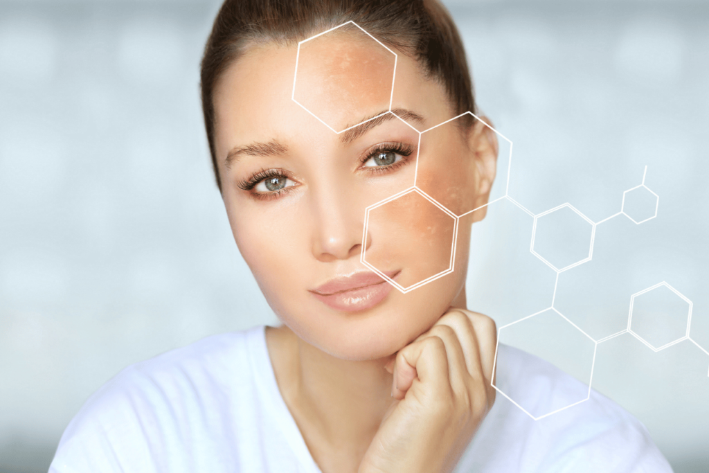microneedling benefits: Skin Tone.